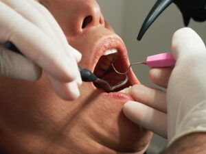Root Canal Treatment in McAllen, TX