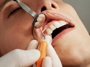 Dental Crown Procedure in McAllen, TX